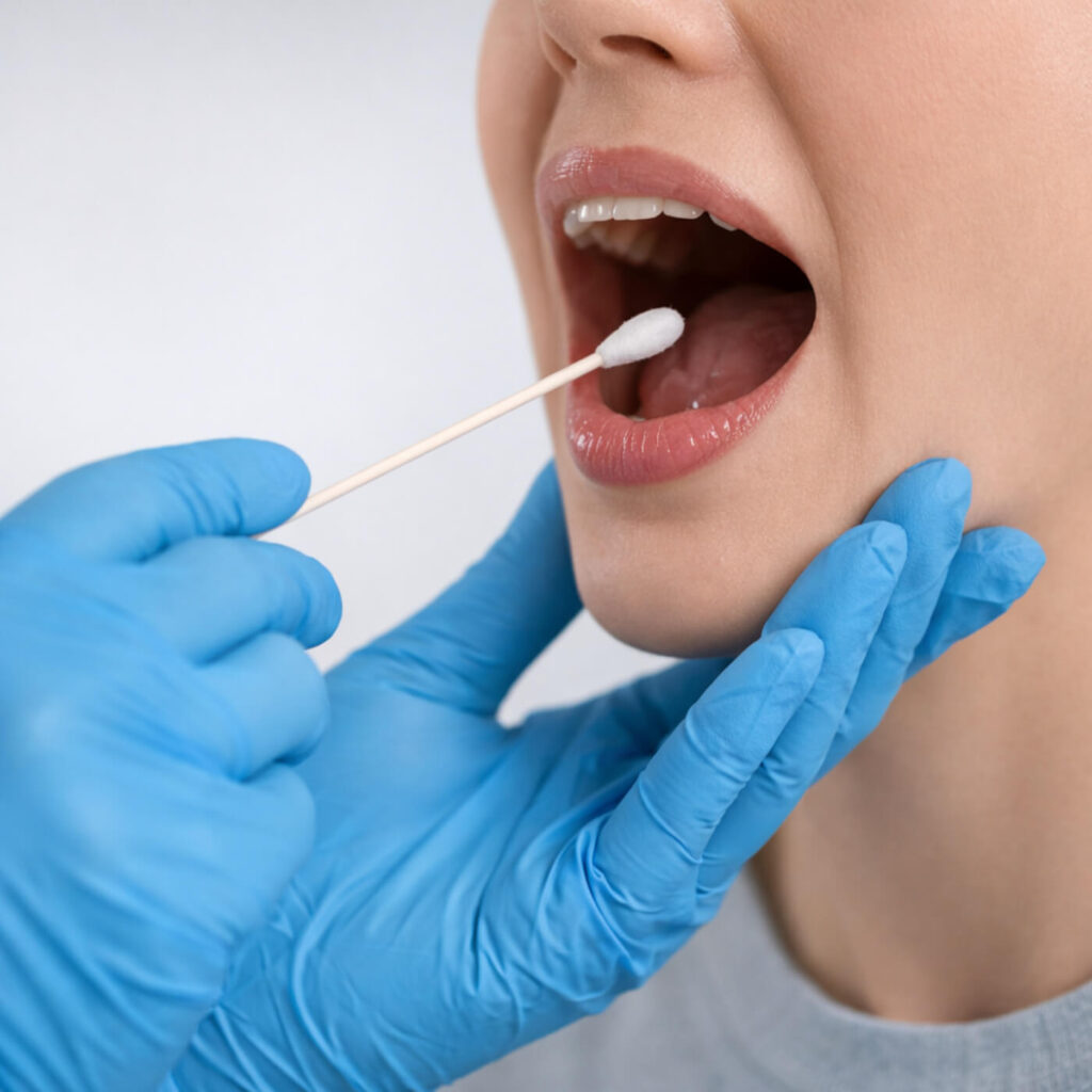 tampone-streptococco-farmacia-europa